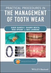 Practical Procedures In The Management Of Tooth Wear Subir Banerji Shamir B Mehta Niek Opdam Bas Loomans