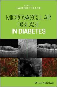 Microvascular Disease In Diabetes Francesco Tecilazich