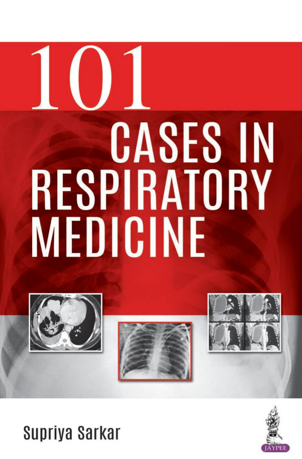 101 Cases In Respiratory Medicine 1st Edition Supriya Sarkar