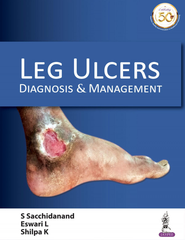 Leg Ulcers Diagnosis And Management 1st Edition S Sacchidanand Eswari L Shilpa K