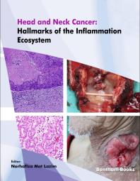 Head And Neck Cancer Hallmarks Of The Inflammation Ecosystem 1st Edition Norhafiza Mat Lazim