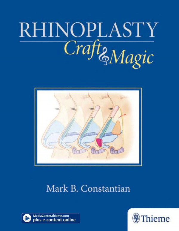 Rhinoplasty Craft Magic Mark B Constantian