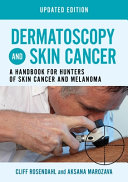 Dermatoscopy And Skin Cancer Updated Edition A Handbook For Hunters Of Skin Cancer And Melanoma Cliff Rosendahl