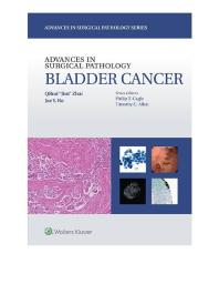 Advances In Surgical Pathology Bladder Cancer Qihui Jim Zhai Jae Y Ro