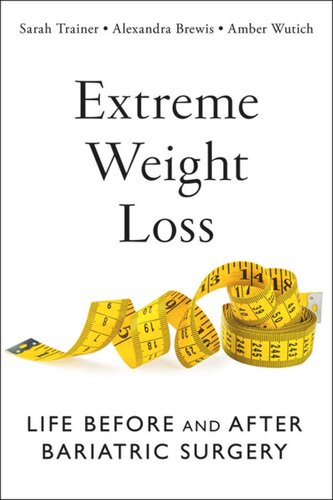Extreme Weight Loss Life Before And After Bariatric Surgery Sarah Trainer Alexandra Brewis Amber Wutich