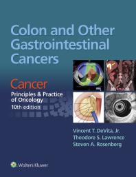 Colon And Other Gastrointestinal Cancers Cancer Principles And Practice Of Oncology 10th Edition 10th Edition Vincent T Devita Theodore S Lawrence Steven A Rosenberg