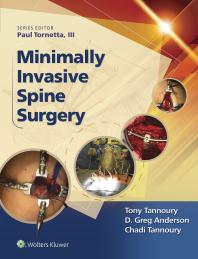 Minimally Invasive Spine Surgery Chadi Tannoury