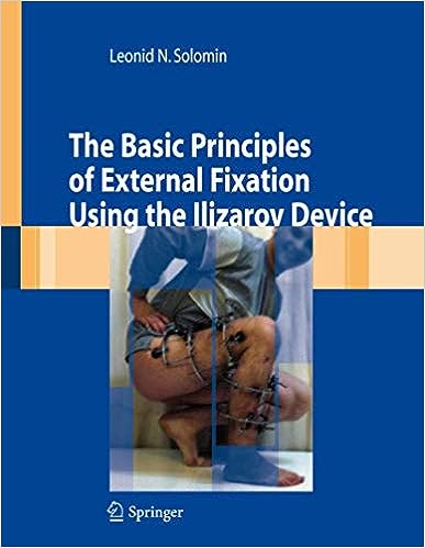 The Basic Principles Of External Fixation Using The Ilizarov Device 1st Edition Leonid Nsolomin