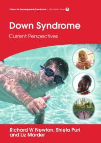Down Syndrome Current Perspectives 1st Edition Richard W Newton Liz Marder Shiela Puri