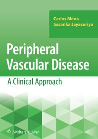 Peripheral Vascular Disease A Clinical Approach Carlos Mena Sasanka Jayasuriya