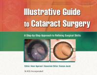 Illustrative Guide To Cataract Surgery A Stepbystep Approach To Refining Surgical Skills 1st Edition Amar Agarwal