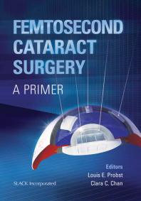 Femtosecond Cataract Surgery A Primer 1st Edition Louis Probst Clara Chan