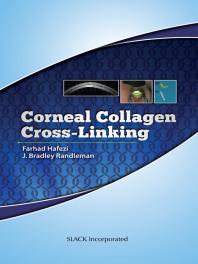 Corneal Collagen Cross Linking 1st Edition Farhad Hafezi J Bradley Randleman