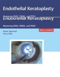 Endothelial Keratoplasty Mastering Dsek Dmek And Pdek 1st Edition Amar Agarwal Terry Kim