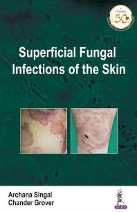 Superficial Fungal Infections Of The Skin 1st Edition Archana Singal Chander Grover