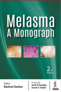 Melasma A Monograph 2nd Edition Rashmi Sarkar