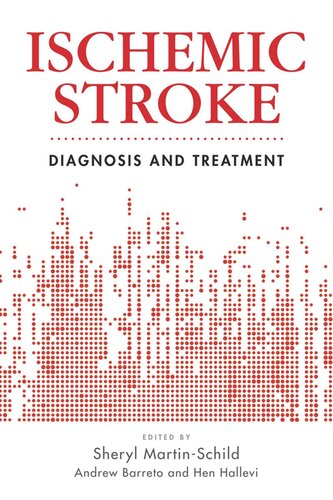 Ischemic Stroke Diagnosis And Treatment