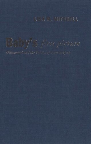 Babys First Picture Ultrasound And The Politics Of Fetal Subjects Lisa M Mitchell
