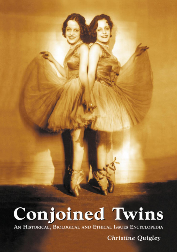 Conjoined Twins An Historical Biological And Ethical Issues Encyclopedia 1st Edition Christine Quigley