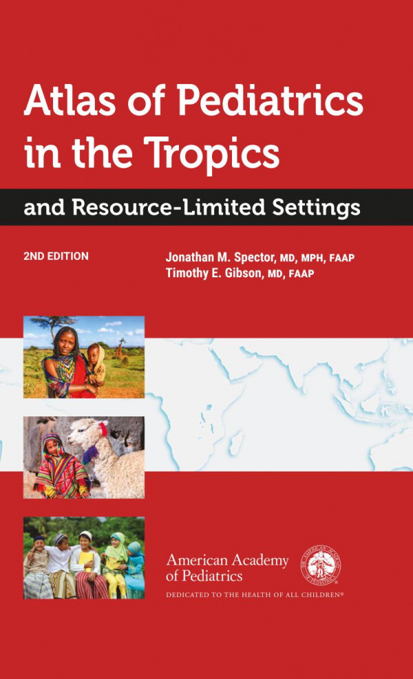 Atlas Of Pediatrics In The Tropics And Resourcelimited Settings 2nd Edition Jonathan M Spector Timothy E Gibson