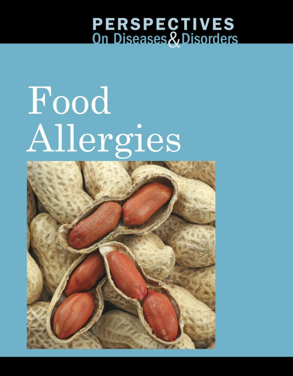 Food Allergies 1st Edition Arthur Gillard
