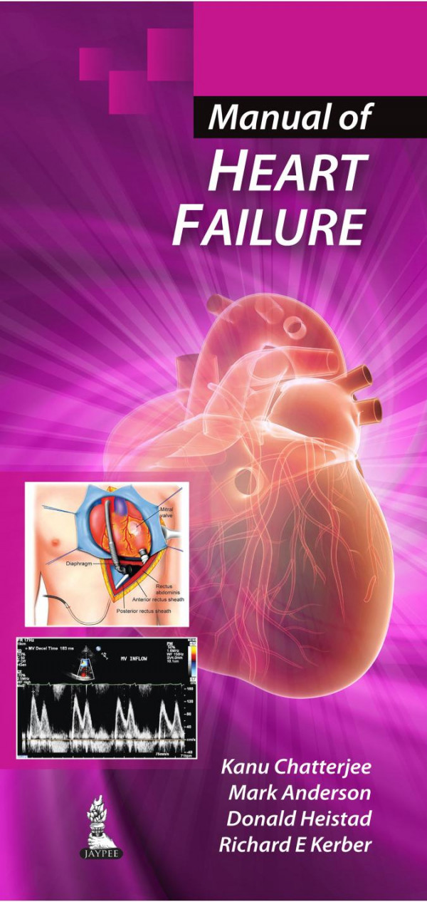 Manual Of Heart Failure 1st Edition Kanu Chatterjee