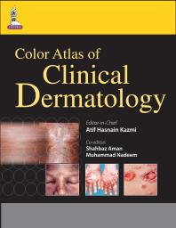 Color Atlas Of Clinical Dermatology 1st Edition Atif Hasnain Kazmi Shahbaz Aman Muhammad Nadeem
