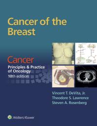 Cancer Of The Breast From Cancer Principles And Practice Of Oncology 10th Edition 10th Edition Vincent T Devita Theodore S Lawrence Steven A Rosenberg
