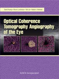 Optical Coherence Tomography Angiography Of The Eye 1st Edition David Huang Bruno Lumbroso