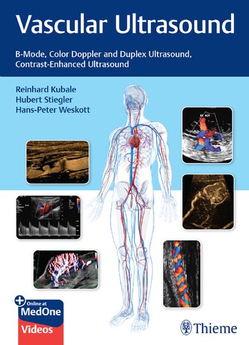 Vascular Ultrasound Bmode Color Doppler And Duplex Ultrasound Contrastenhanced Ultrasound Teamira True Pdf 1st Edition Reinhard Kubale Editor