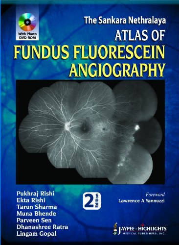 The Sankara Nethralaya Atlas Of Fundus Fluorescein Angiography 2nd Edition 2013 Pukhraj Rishi