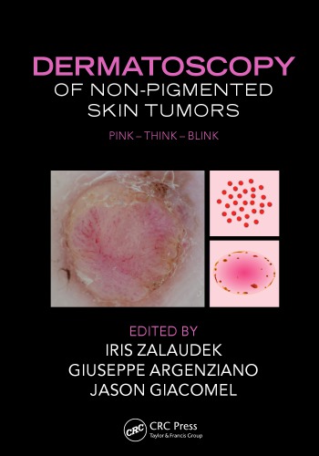 Dermatoscopy Of Nonpigmented Skin Tumors Pink Think Blink Argenziano