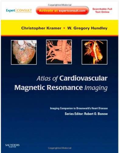Atlas Of Cardiovascular Magnetic Resonance Imaging Expert Consult Online And Print Imaging Companion To Braunwalds Heart Disease 1e Harpsc Christopher M Kramer Md