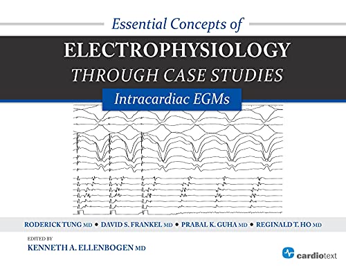 Essential Concepts Of Electrophysiology Through Case Studies Intracardiac Egms 1st Edition Kenneth A Ellenbogen