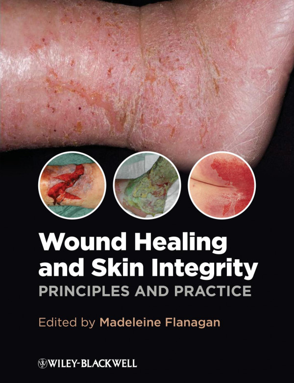 Wound Healing And Skin Integrity Principles And Practice Flanagan