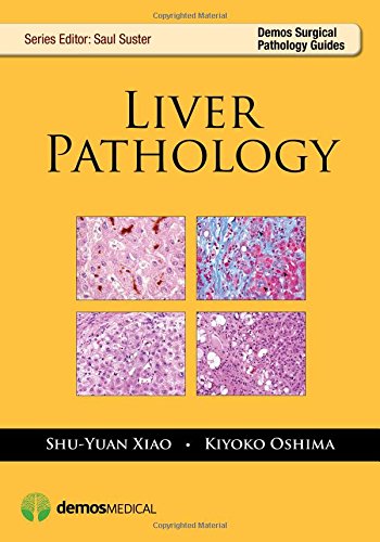 Liver Pathology 1st Edition Shuyuan Xiao Kiyoko Oshima Md