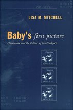 Babys First Picture Ultrasound And The Politics Of Fetal Subjects 1st Edition Lisa M Mitchell