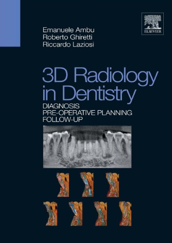3d Radiology In Dentistry Diagnosis Preoperative Planning Followup Emanuele Ambu