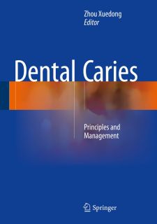 Dental Caries Principles And Management 1st Ed 2016 Zhou Xuedong