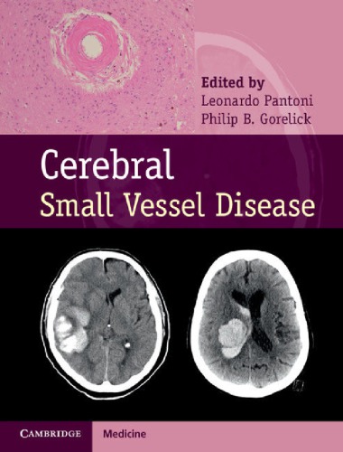 Cerebral Small Vessel Disease 1st Edition Leonardo Pantoni Philip B Gorelick