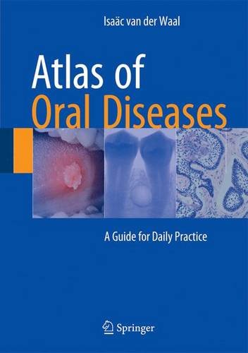 Atlas Of Oral Diseases A Guide For Daily Practice 1st Edition Isac Van Der Waal