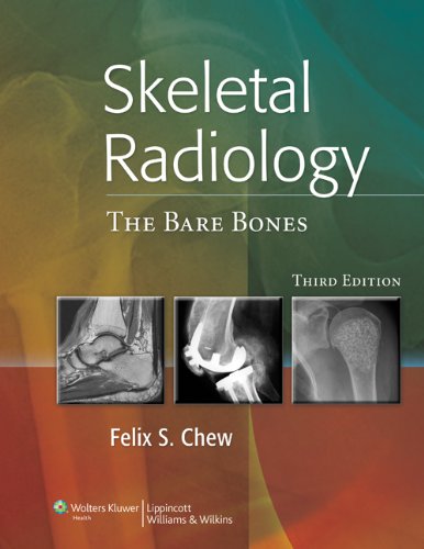 Skeletal Radiology The Bare Bones Third Felix S Chew