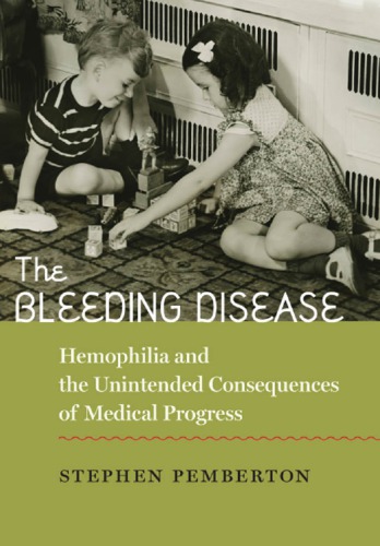 The Bleeding Disease Hemophilia And The Unintended Consequences Of Medical Progress Stephen Pemberton