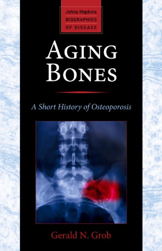 Aging Bones A Short History Of Osteoporosis Gerald N Grob