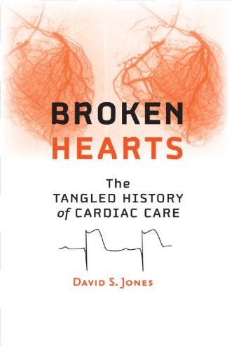 Broken Hearts The Tangled History Of Cardiac Care David S Jones