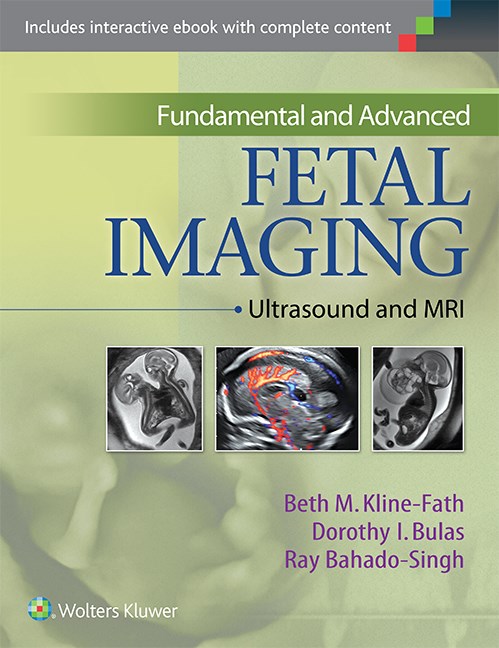 Fundamental And Advanced Fetal Imaging Ultrasound And Mri Beth M Klinefath
