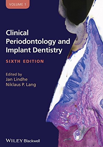 Clinical Periodontology And Implant Dentistry 2 Volume Set 6th Edition Niklaus P Lang