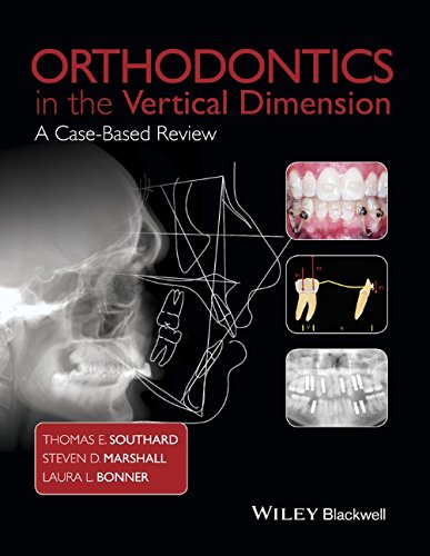 Orthodontics In The Vertical Dimension A Casebased Review 1st Edition T E Southard