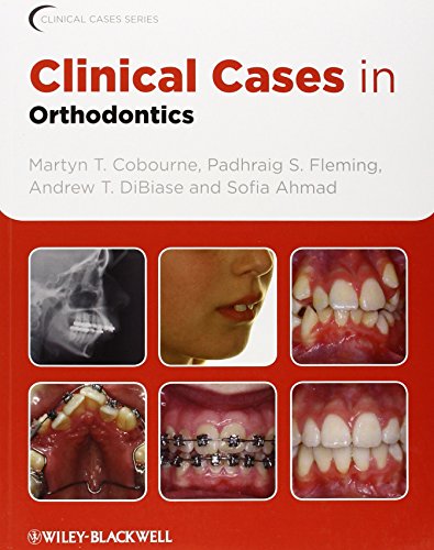 Clinical Cases In Orthodontics 1st Edition M T Cobourne P S Fleming