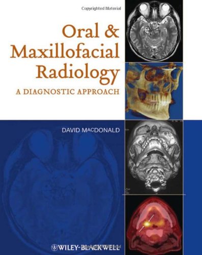 Oral And Maxillofacial Radiology A Diagnostic Approach 1st Edition David Macdonald